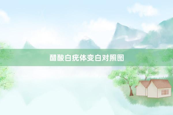 醋酸白疣体变白对照图